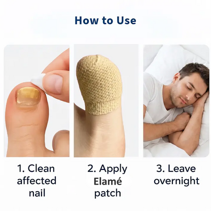 Elamé™ Nail Repair Patches